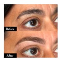 Before & After Colour Expert